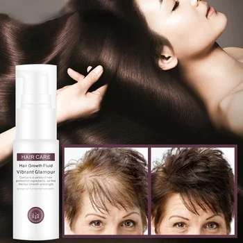 Plaukų Augimo Gydymo Alyva, Stabdžių Plaukų Slinkimas Esmė Natūralų Sveikų Plaukų Gydymą Greitai Storio Plaukų Moters, Vyro, Plaukų Priežiūros Produktai